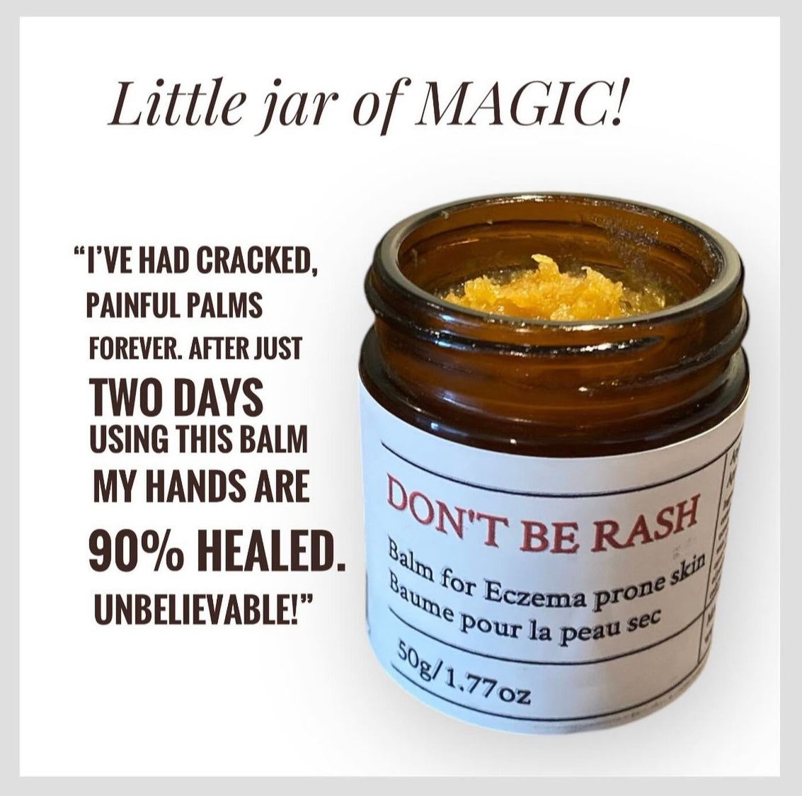 Don't Be Rash - Eczema & Dry Skin Balm – Little Tree Hugger Naturals